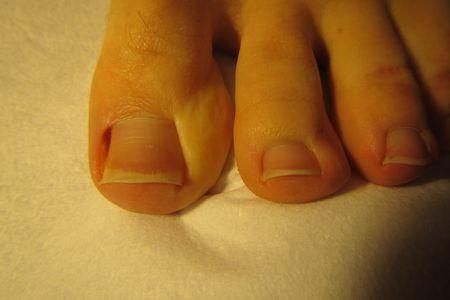 Kobiece palce u stopy